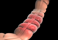 【健康科普】武宁县人民医院体检保健科：吃饭有这3个习惯，可能会被癌症“盯上”！