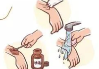 【急诊第一线】武宁县人民医院急诊科成功救治一名毒蛇咬伤患者