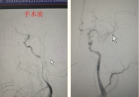 【生命绿色通道】武宁县总医院人民医院院区卒中中心
