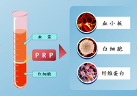 【新技术】武宁县总医院人民医院院区骨科：富血小板血浆（PRP）注射疗法